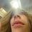 radiish